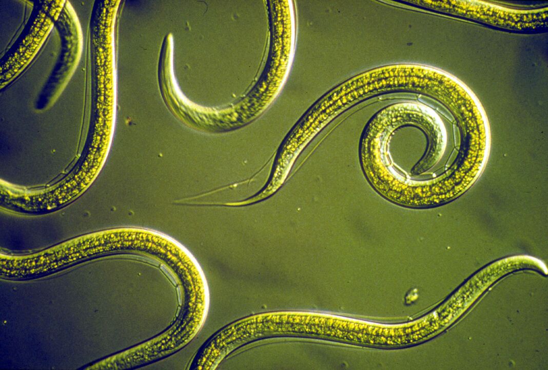 Pinworms από το ανθρώπινο σώμα